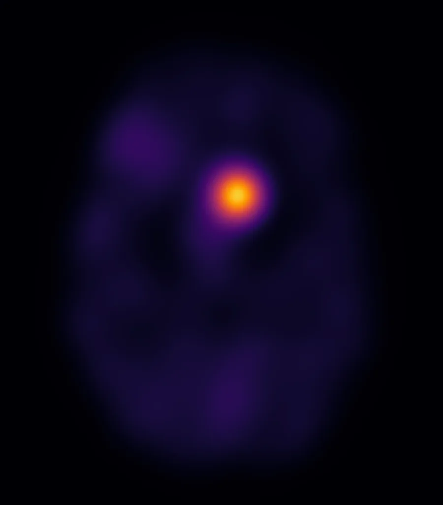 Radar contrast map